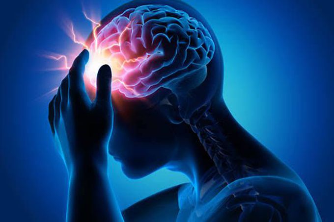 Treatment of migraine
