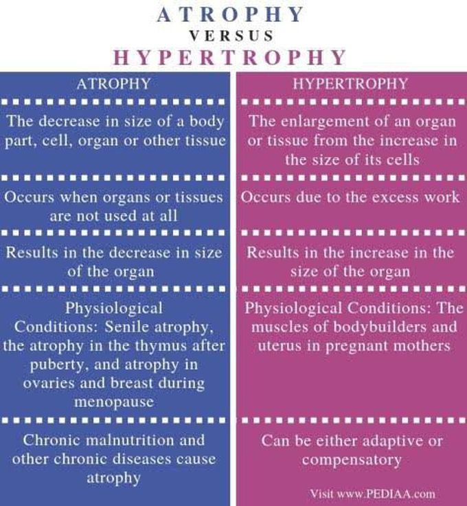 Atrophy Vs Hypertrophy