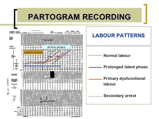 Partogram Recording