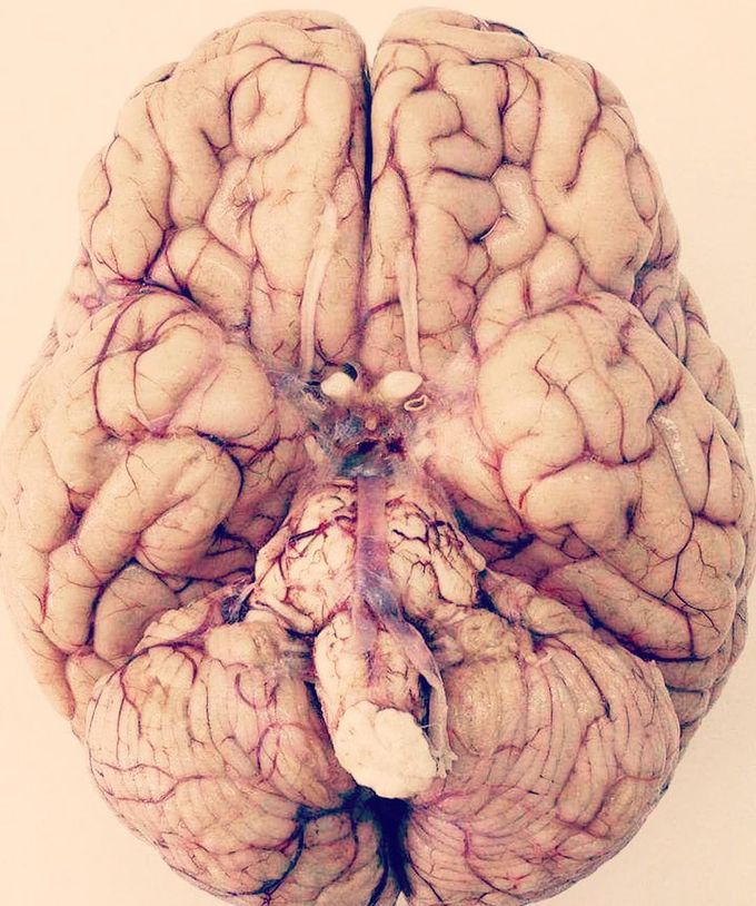 Very unique view of the brain