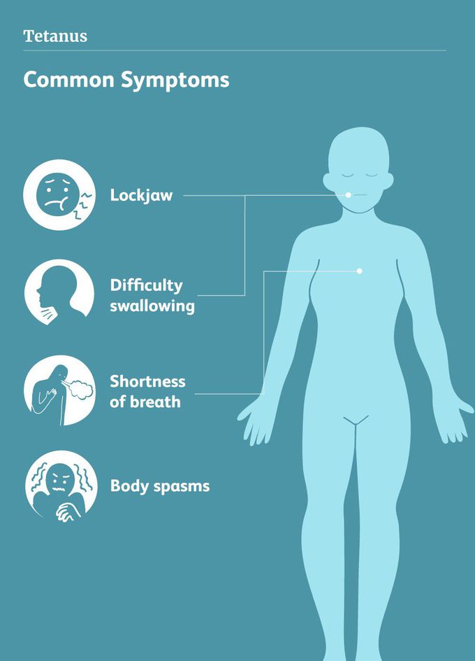 Symptoms of Tetanus