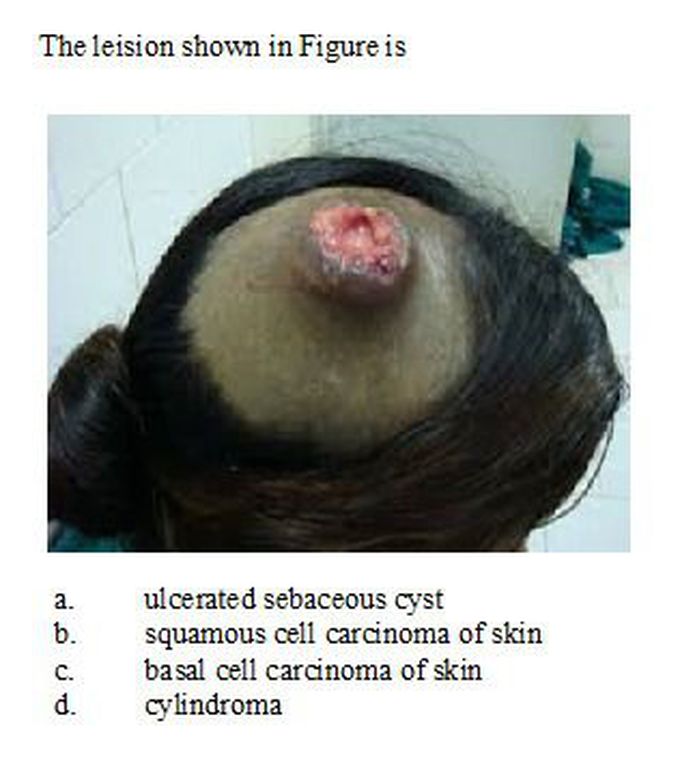 Derma