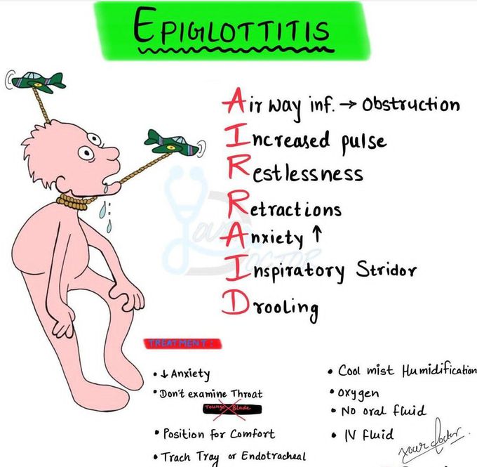 Epiglottitis