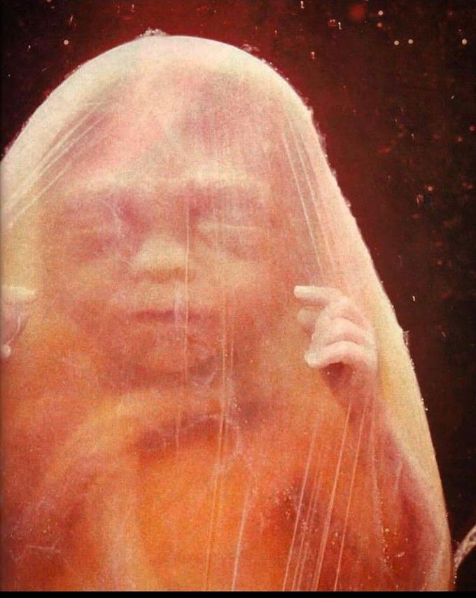 Unborn beauty