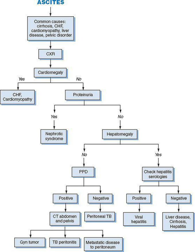 Ascites