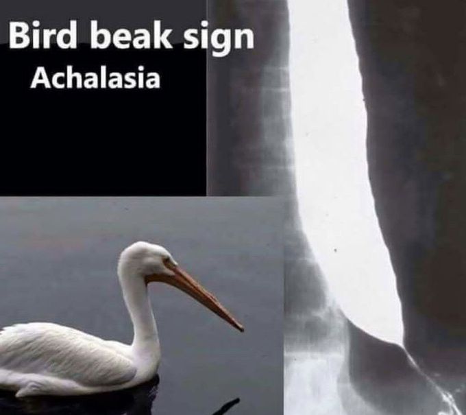 Bird Beak Sign