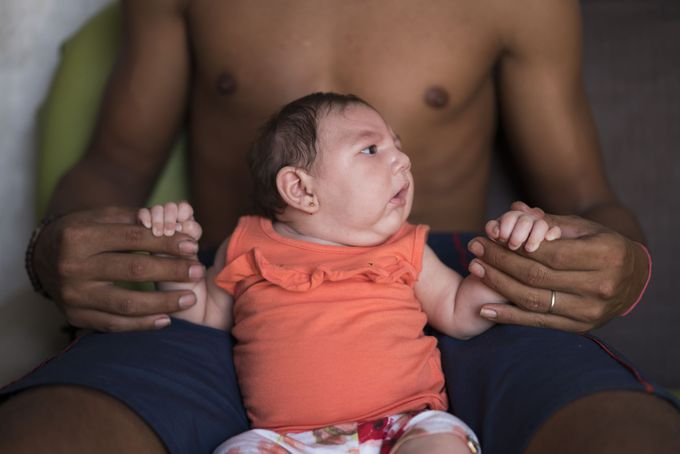 Zika virus