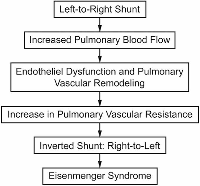 Pathway mechanism of Eisenmenger syndrome