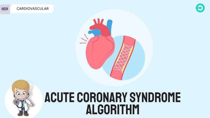 Acute coronary syndrome algorithm by ACLS