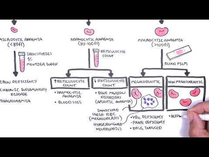 Overview of anemia