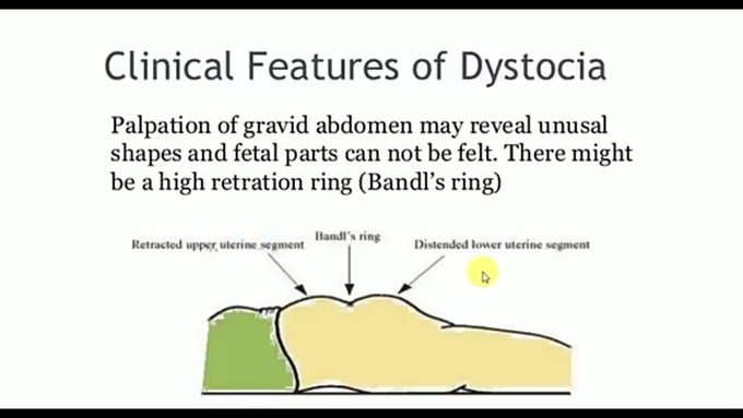 Clinical features of dystocia