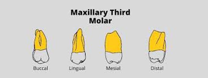 Anatomy of upper third molar roots