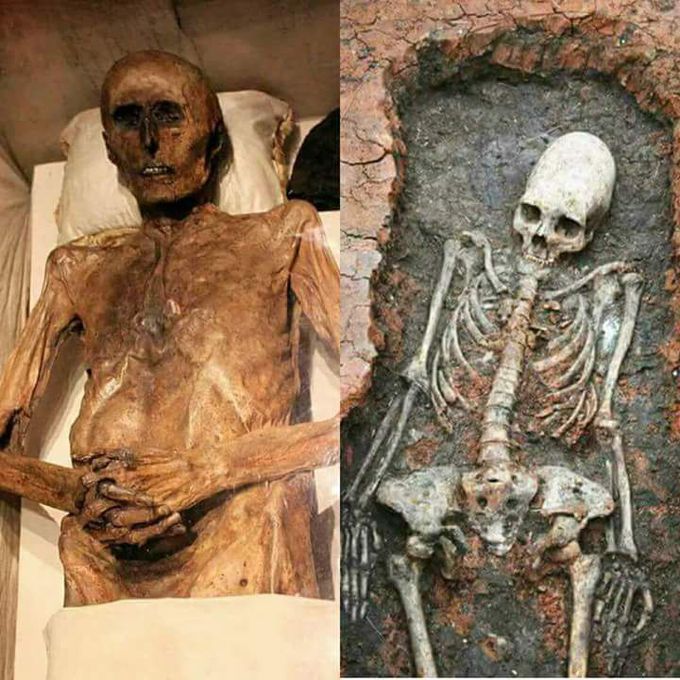 Cadaver