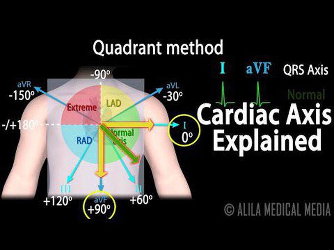 Cardiac axis