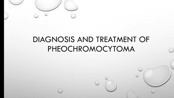 diagnosis and treatment of Pheochromocytoma