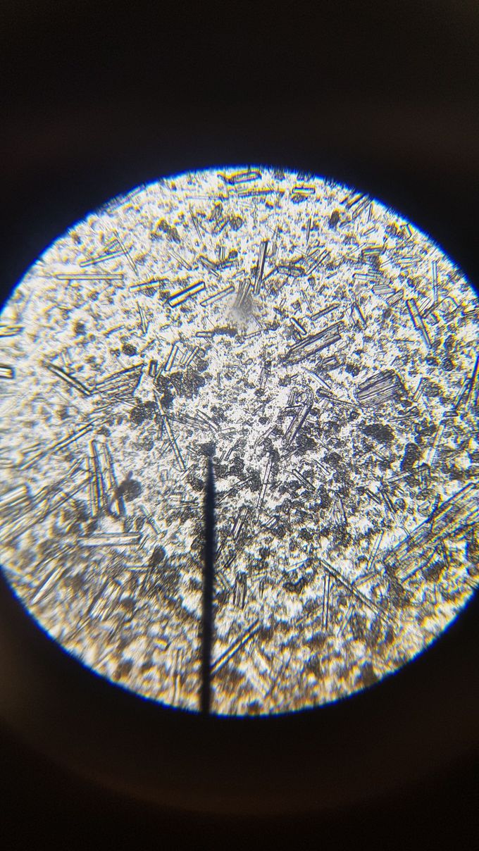 Protein crystals.
