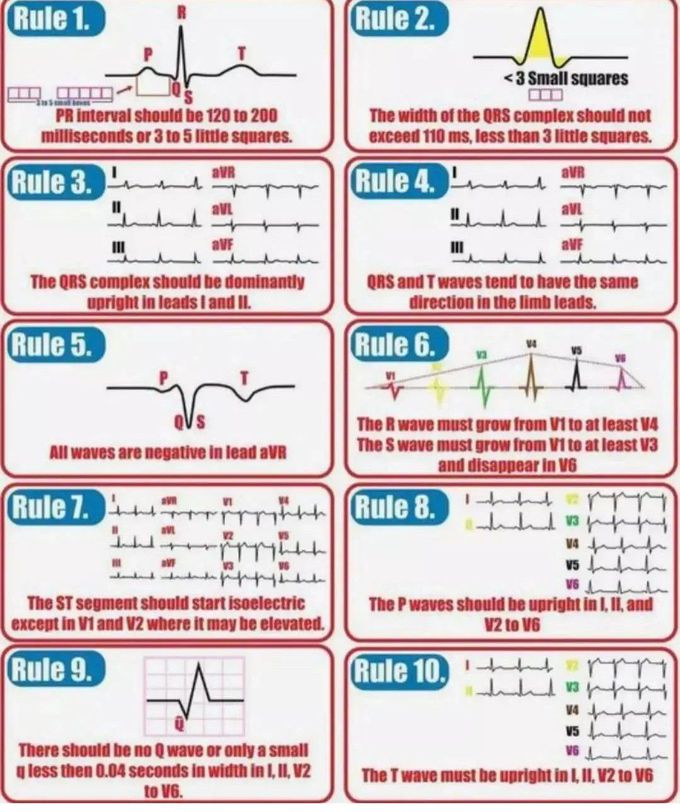 10 Rules of normal ECG