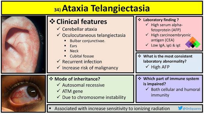 Ataxia Telangiectasia