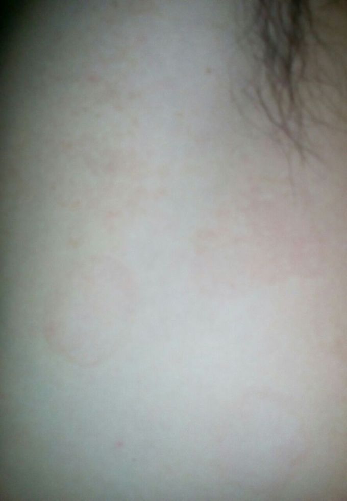 What's diagnosis this patient He has one year ago