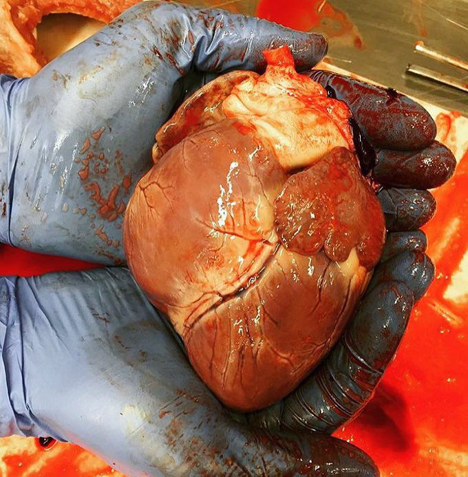 The Heart