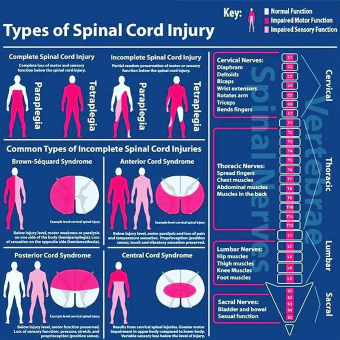 Spinal Cord Lesions