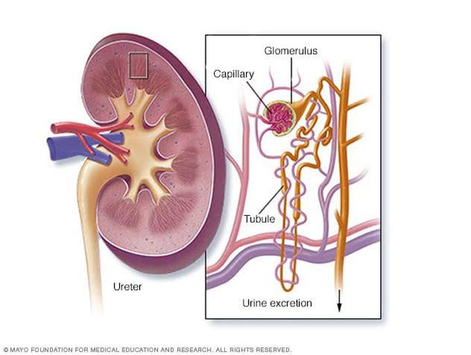 Glomerulonephritis