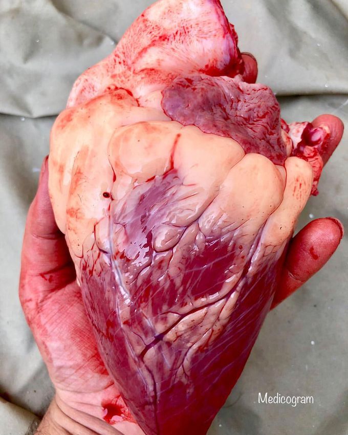 The Heart
