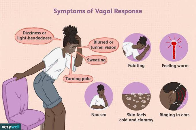 Signs and symptoms of vasovagal syncope