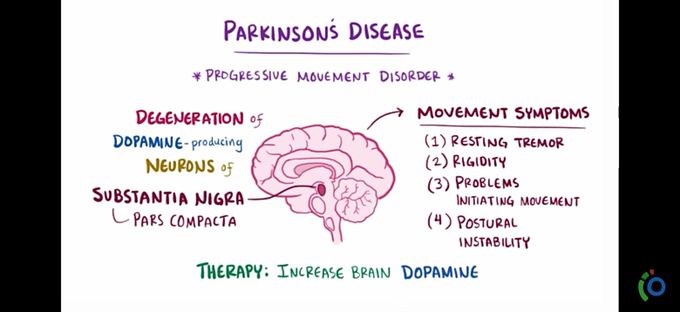 Parkinson's