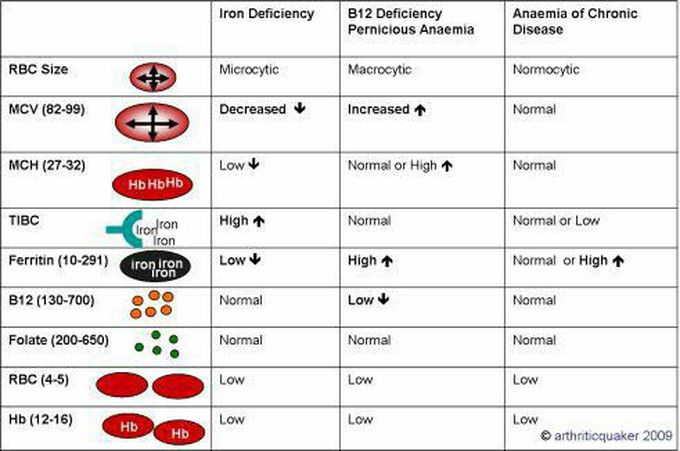 Anemia