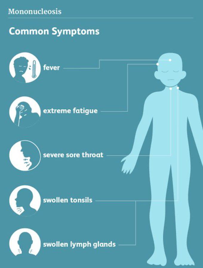 Symptoms of Mononucleosis