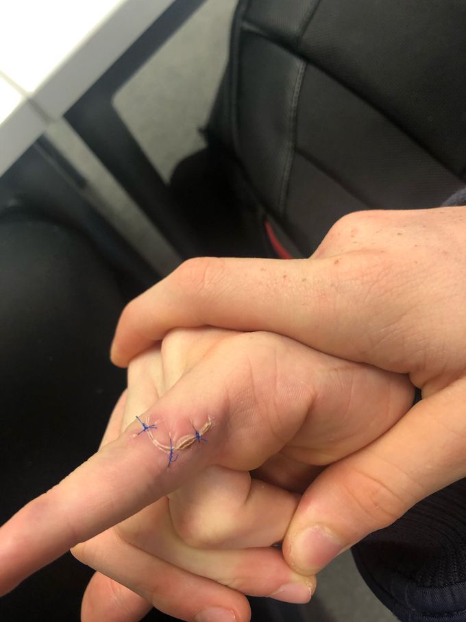 Rate these stitches