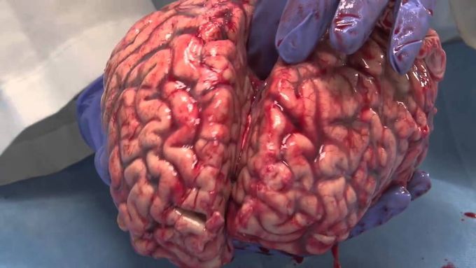 The Unfixed Human Brain Like You Have Never Seen Before