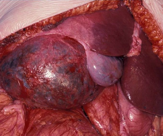 What is your diagnosis ???