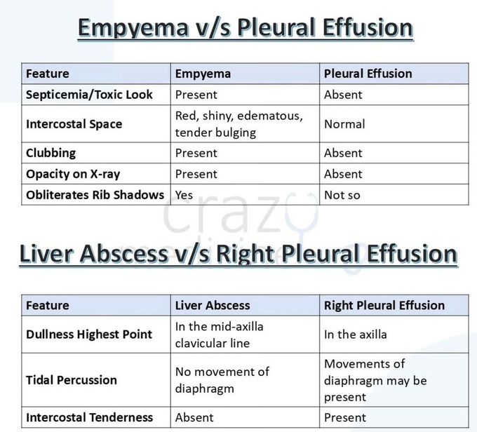 Pleural Effusion X