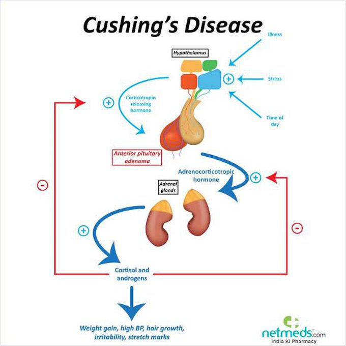 Cushing Disease