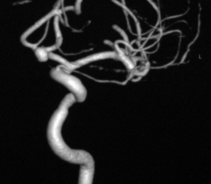 Neurosurgery