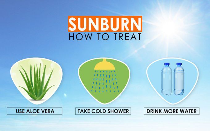 Treatment for Sunburn