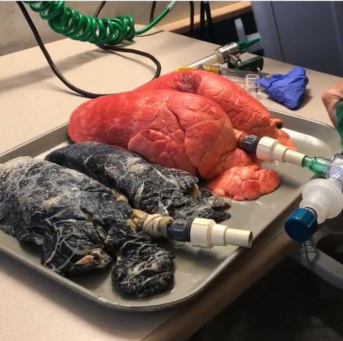 Lungs 👀