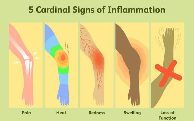 Do you know about Inflammation? - MEDizzy