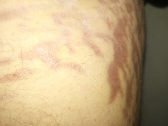 What is diagnosis.