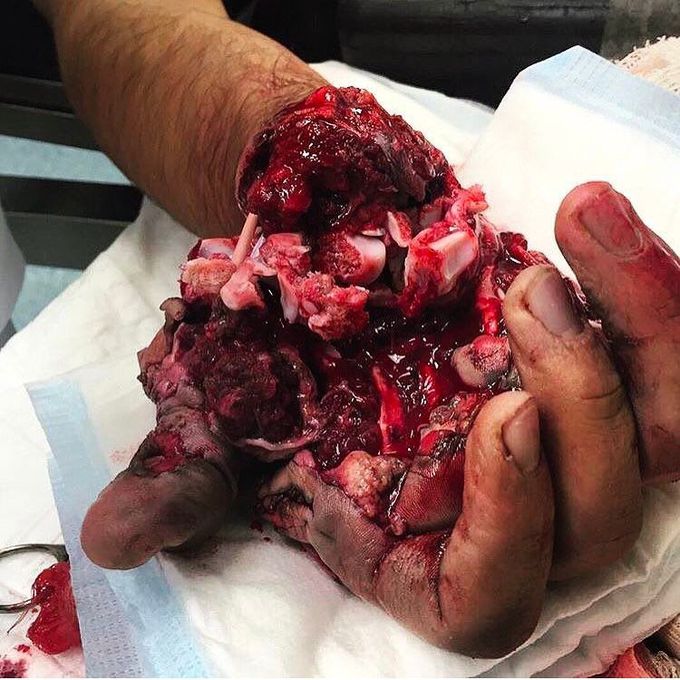 Hand VS. Grenade!
