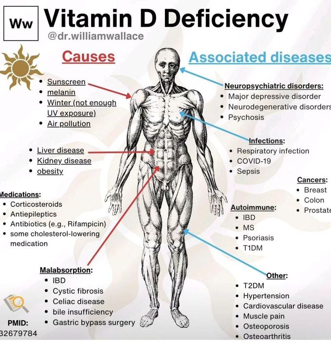 Vitamin D Deficiency