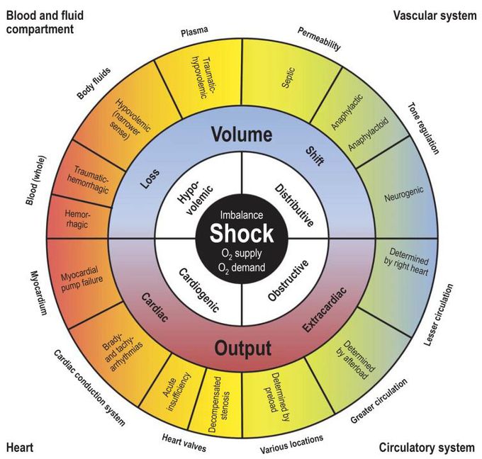 Types of shock