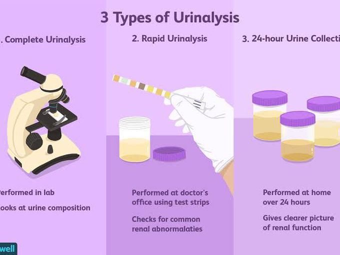 Urinalysis