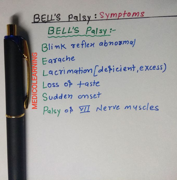 Bell's palsy