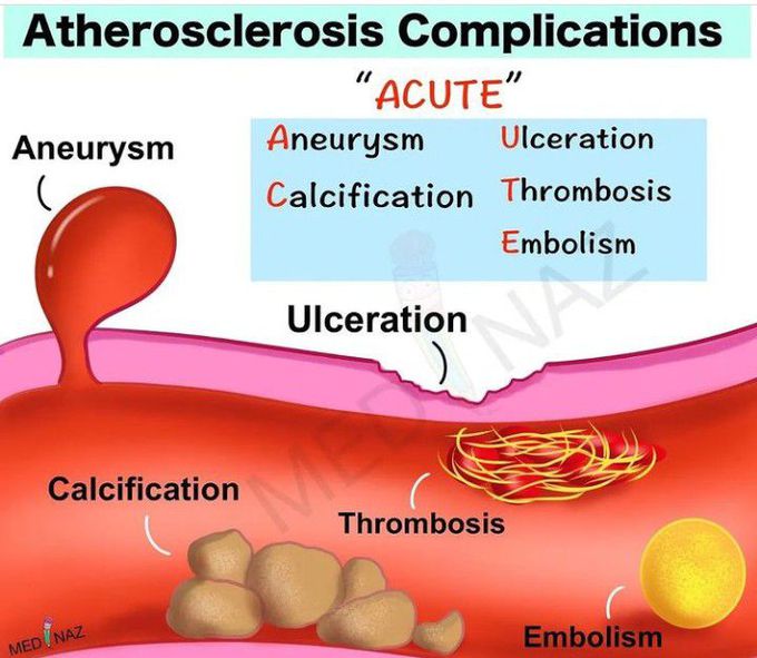 Complications of Atherosclerosis