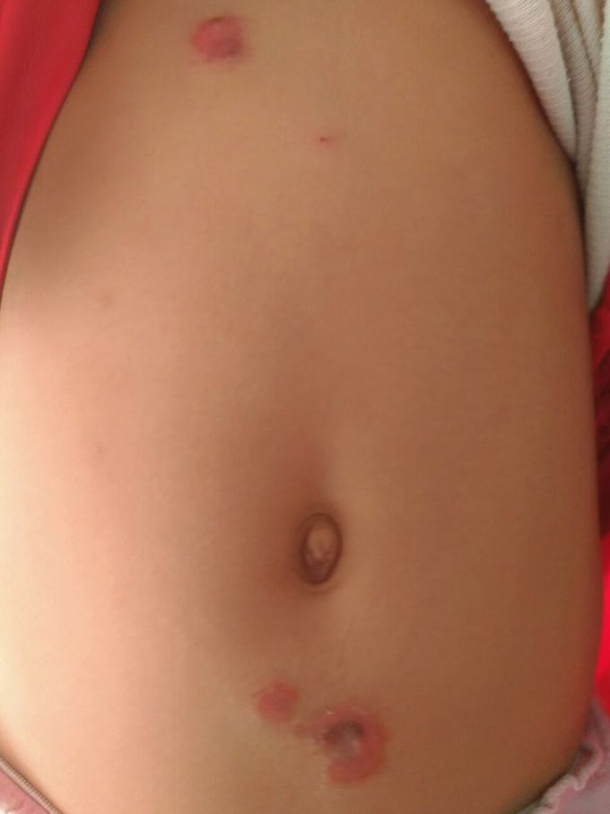 Diagnosis and treatment?