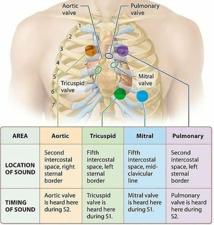 Heart sounds