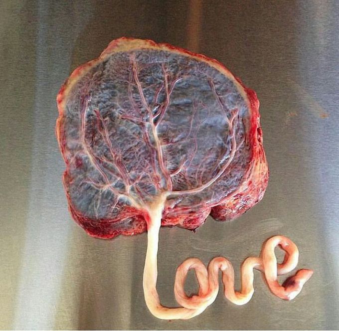 Placenta..